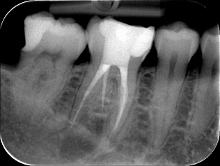dentist, Sheffield, flint, dental